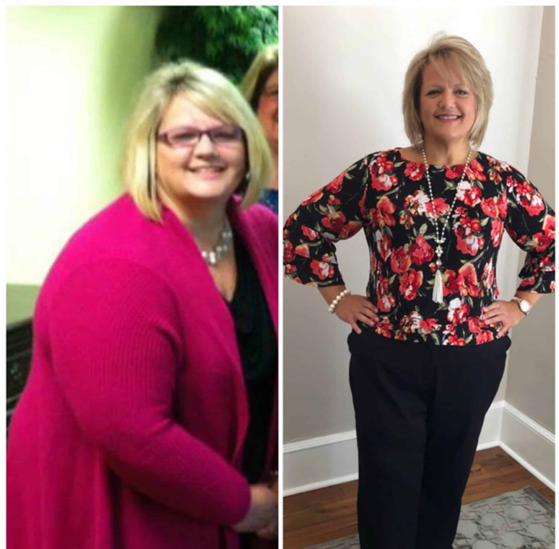 Lisa, Lost 73 lbs